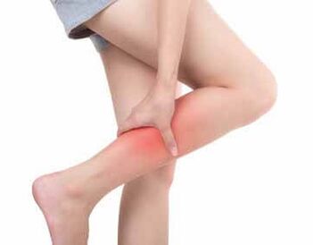 Síntomas de varices
