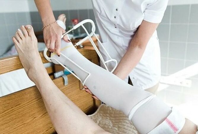 Tempo postoperatorio desde a operación nas veas das pernas