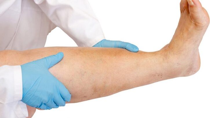 como recoñecer a enfermidade